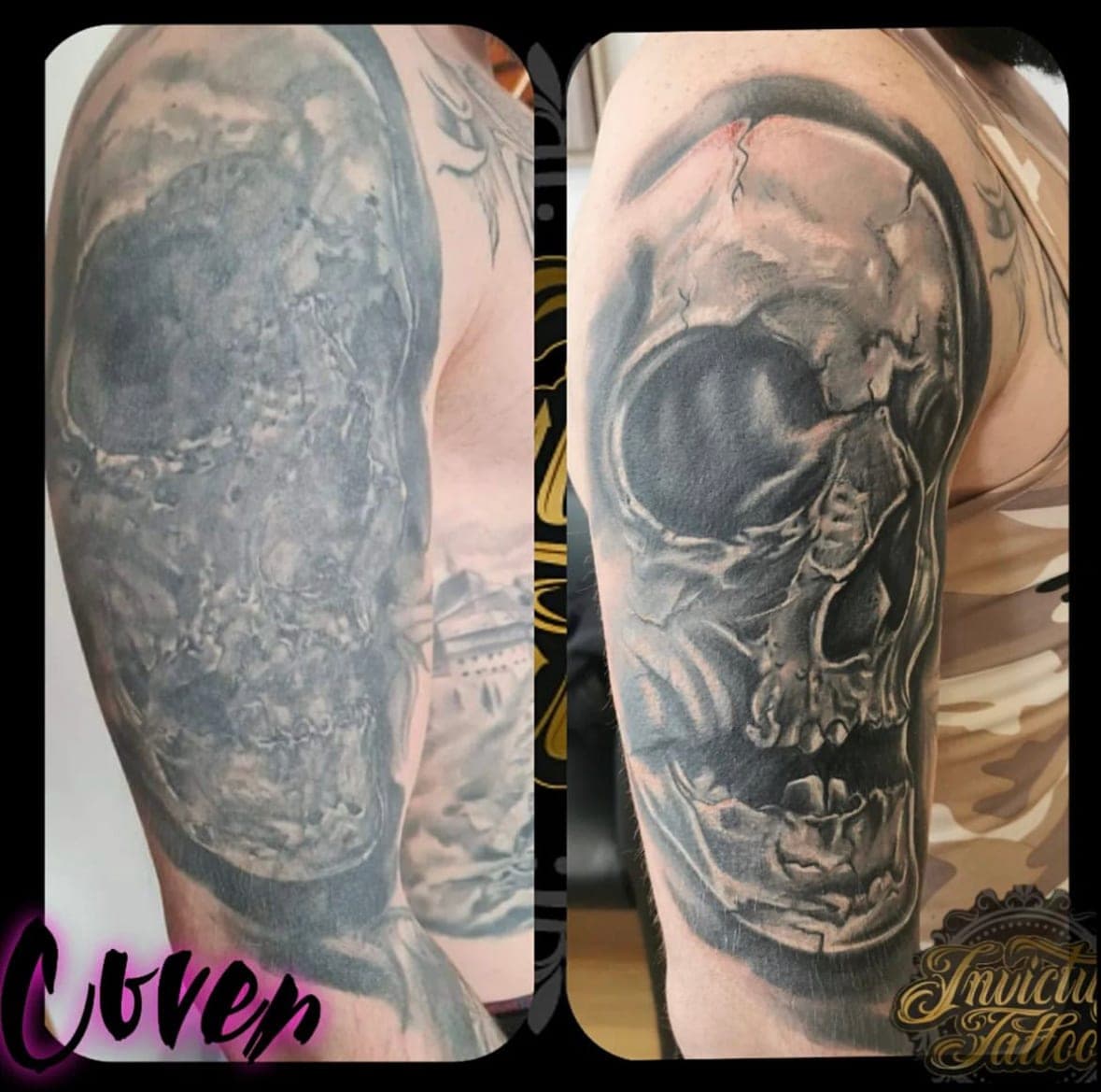 cover up lebka